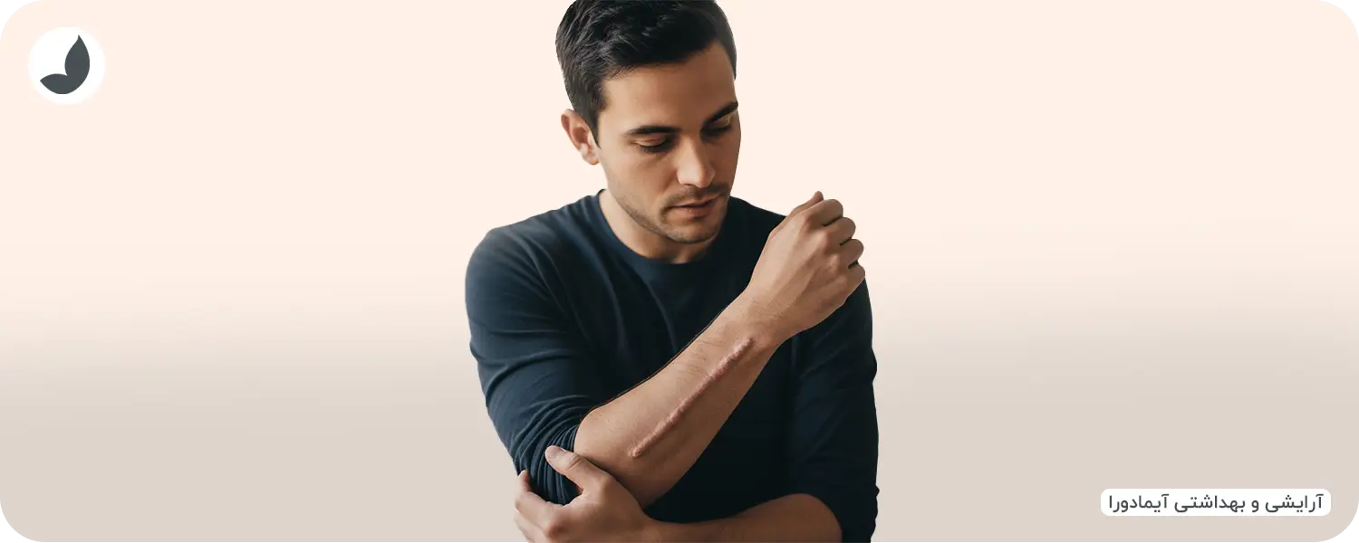 اسکار زخم چیست