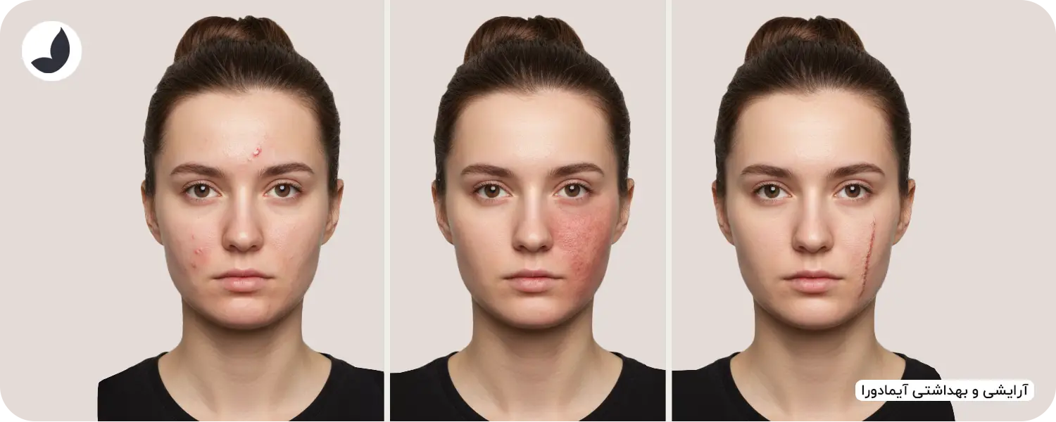 انواع کرم ترمیم کننده