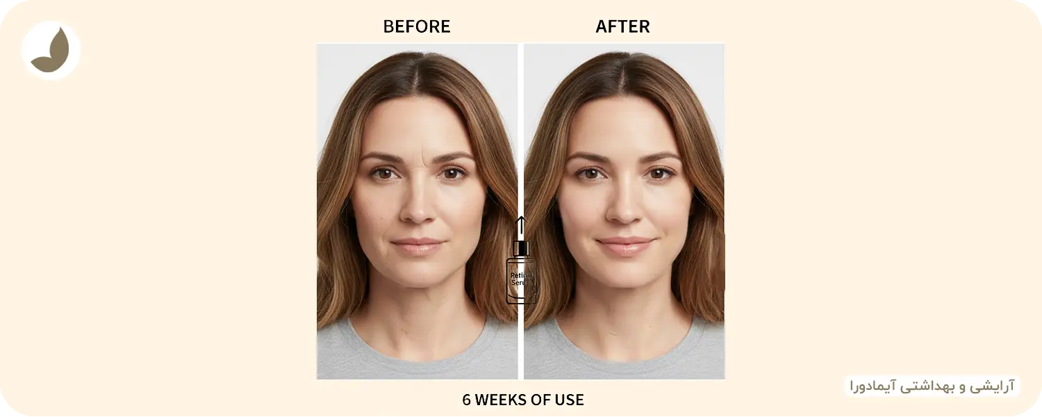 قبل و بعد استفاده از رتینول