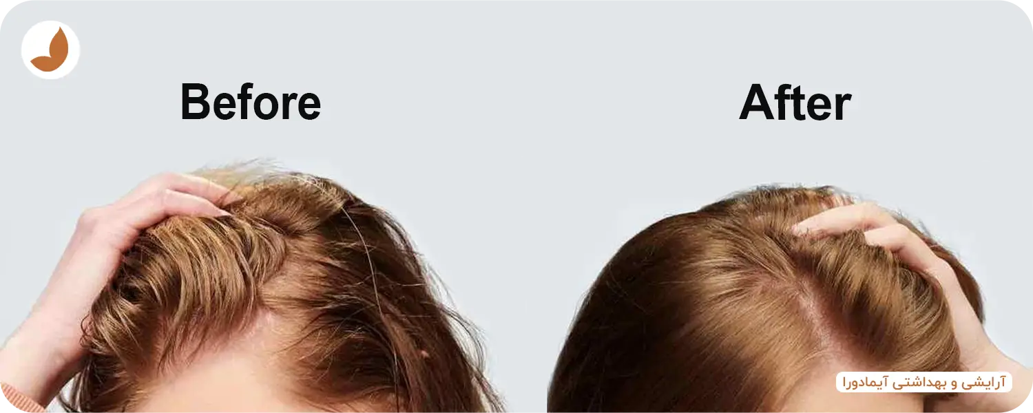 قیمت شامپو خشک