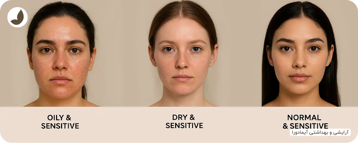 شناسایی دقیق نوع پوست حساس