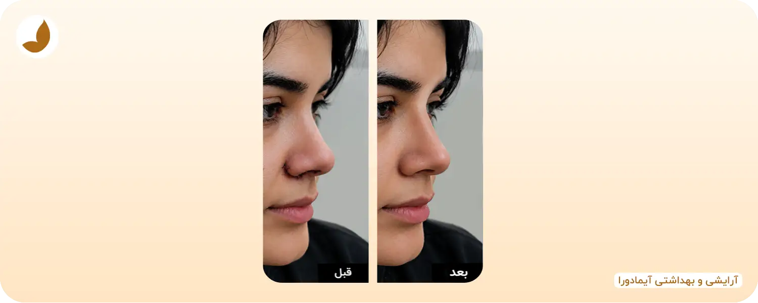 قبل و بعد از استفاده از ترمیم کننده جای بخیه بینی